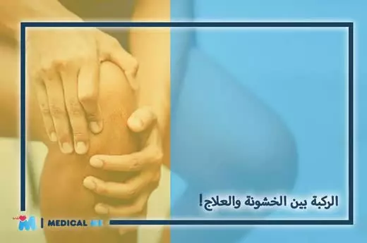 Knee roughness treatment