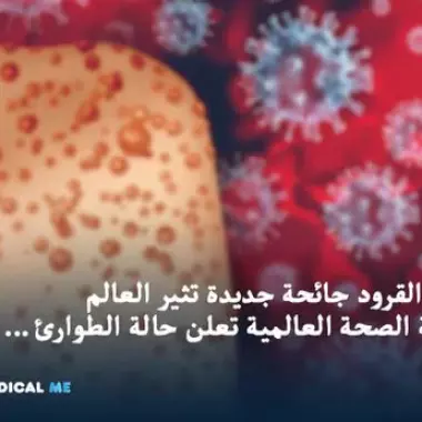 Monkeypox Virus Symptoms, Transmission, Treatment 8 Symptoms Of Severe Vitamin D Deficiency In Females